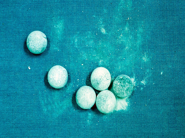 Lead musket balls with surface corrosion caused by exposure to organic acid vapours while displayed in a plywood display cabinet.  Western Australia Museum
